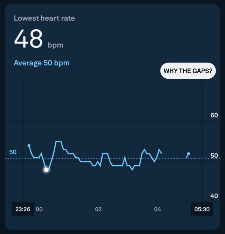 Oura Ring Troubleshooting